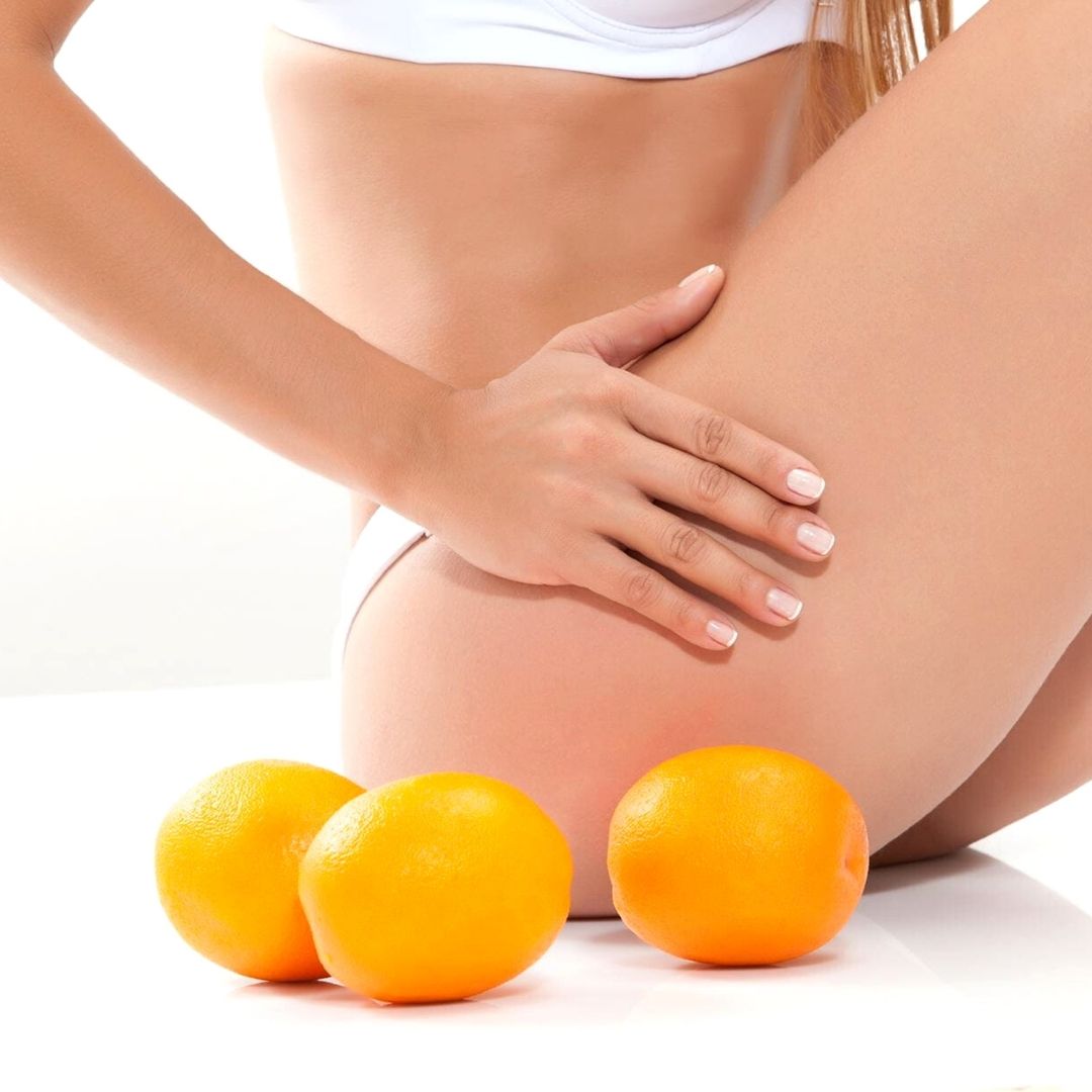 cellulite1.jpg