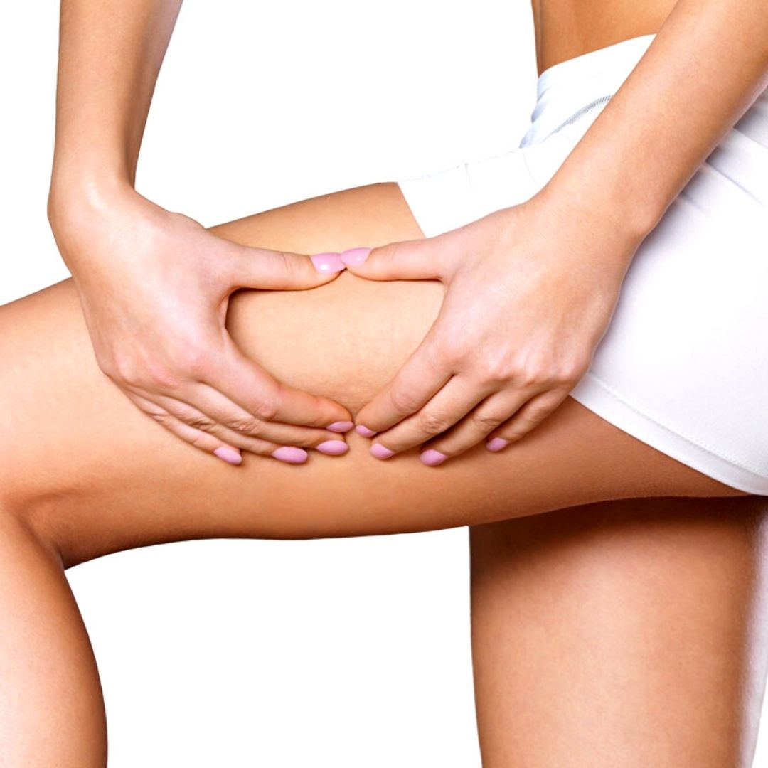 cellulite3.jpg